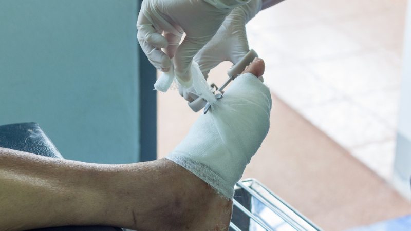 wound care cleveland foot wound care cleveland foot