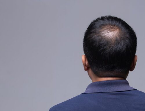 Hair Cloning vs. Hair Multiplication: What’s Actually Possible Right Now