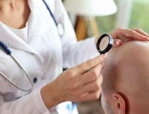 How Modern Hair Transplants Work: From Plugs to Follicular Units