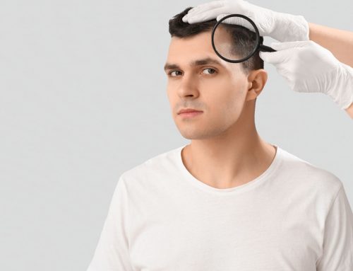 FUE vs. FUT: What Your Surgeon Should Tell You About the Donor Area